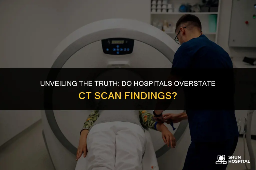 do hospitals exaggerate ct scan results