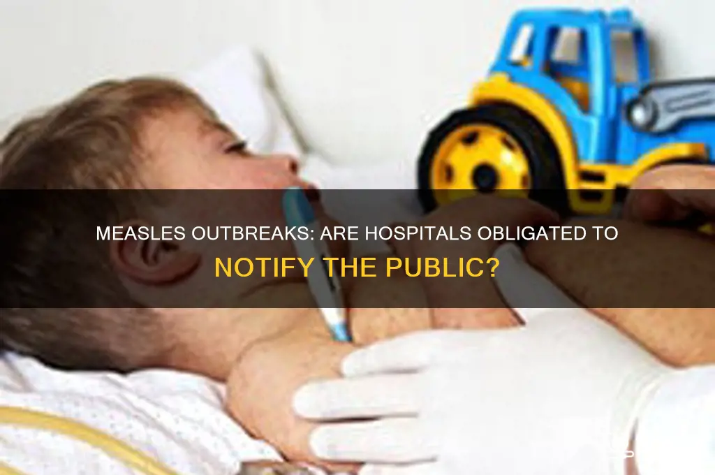 do hospitals have to alert public about measles cases