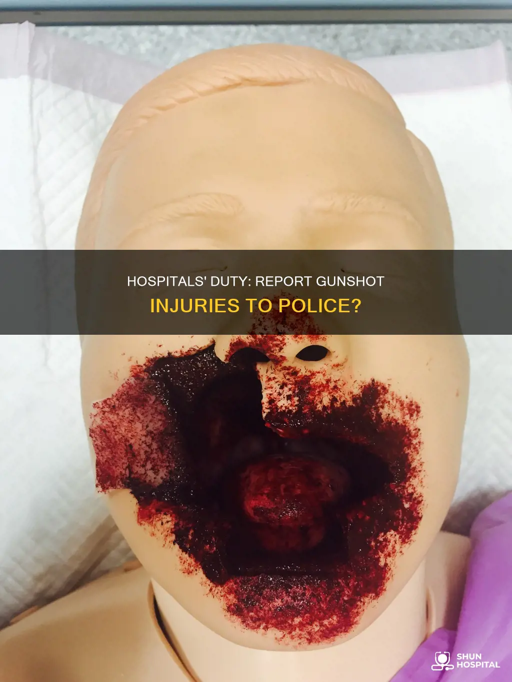 do hospitals have to report bullet wounds