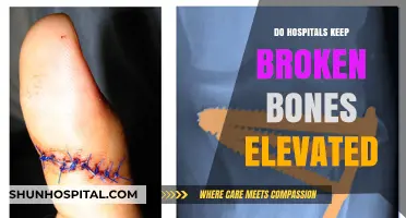 Healing Heights: The Science Behind Elevating Broken Bones in Hospitals