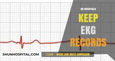 Do Hospitals Keep EKG Records? Understanding Medical Record Retention
