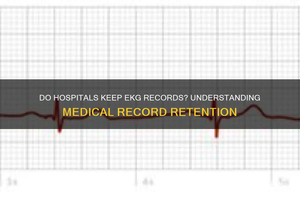 do hospitals keep ekg records