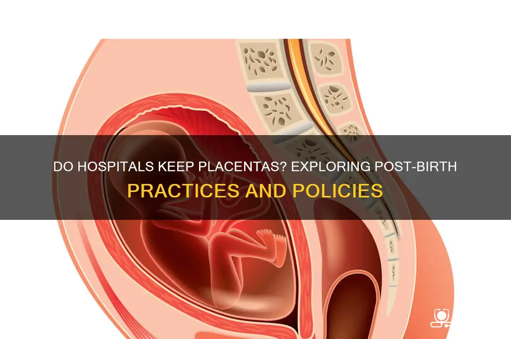 do hospitals keep placentas