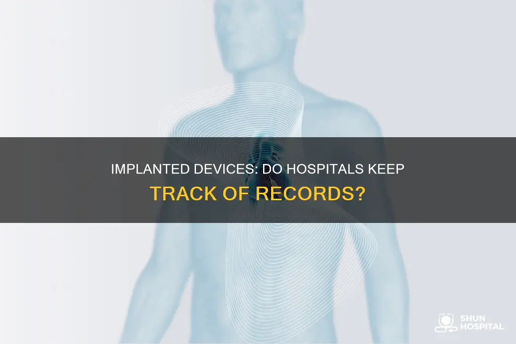 do hospitals keep srecords for implanted devices
