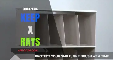 Do Hospitals Retain X-Rays? Understanding Medical Record Storage Policies