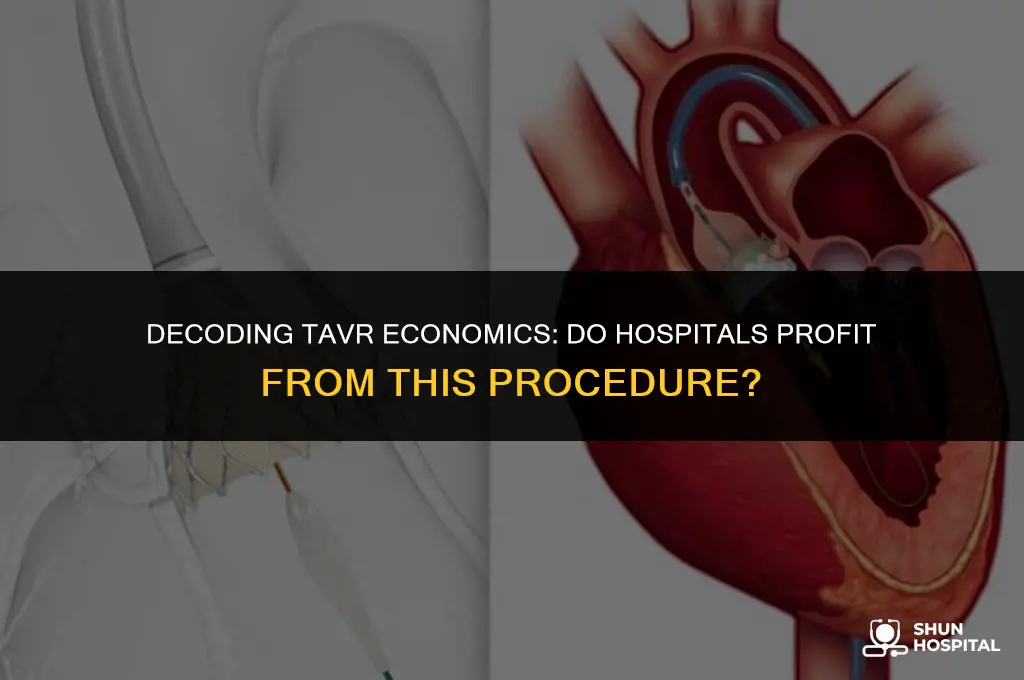 do hospitals make money on tavr