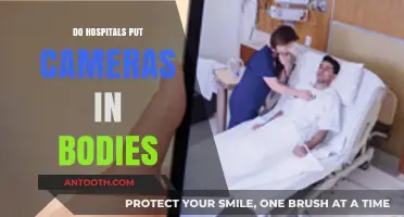 Exploring the Truth: Do Hospitals Implant Cameras in Patients' Bodies?