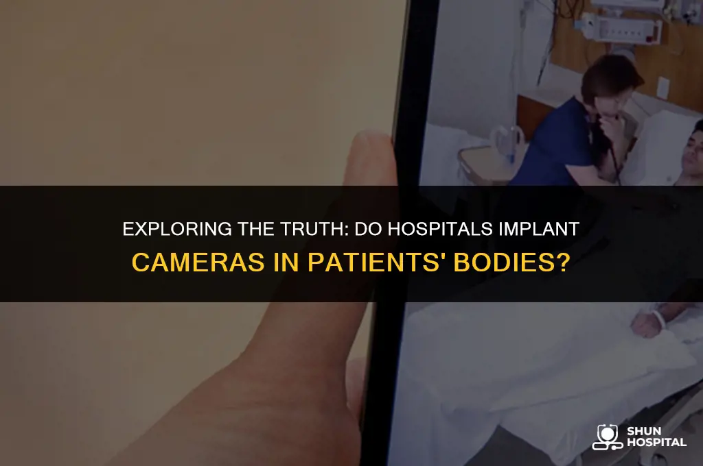 do hospitals put cameras in bodies