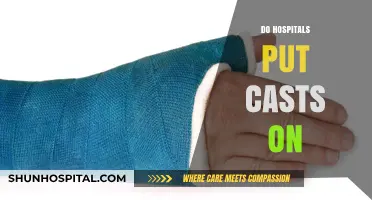 Do Hospitals Put Casts On? Understanding Fracture Treatment in Medical Settings
