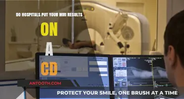 Do Hospitals Provide MRI Results on a CD? Find Out Here