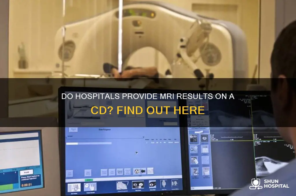 do hospitals put your mri results on a cd