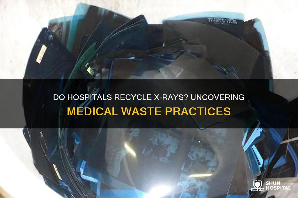 do hospitals recycle xrays
