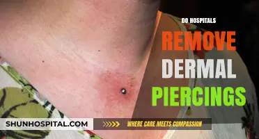 Do Hospitals Remove Dermal Piercings? What You Need to Know