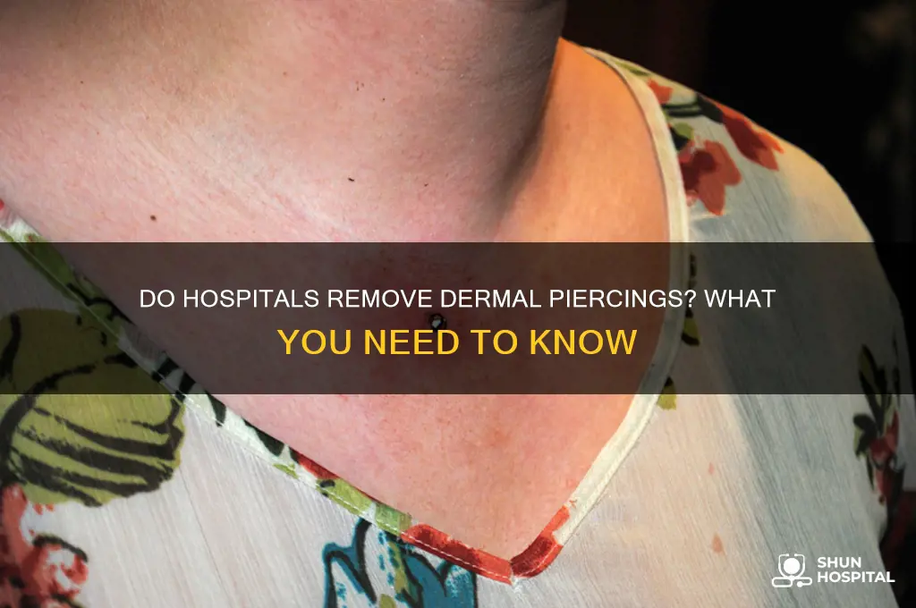 do hospitals remove dermal piercings