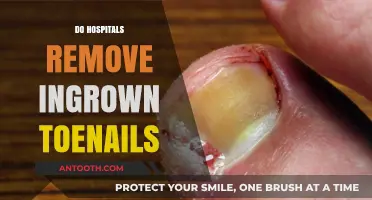 Do Hospitals Remove Ingrown Toenails? Treatment Options Explained