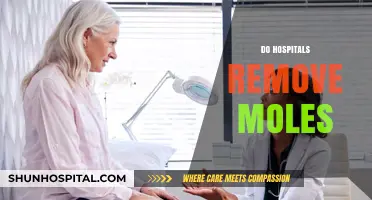 Do Hospitals Remove Moles? Understanding Procedures and Reasons