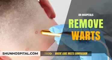 Do Hospitals Remove Warts? Exploring Treatment Options and Procedures