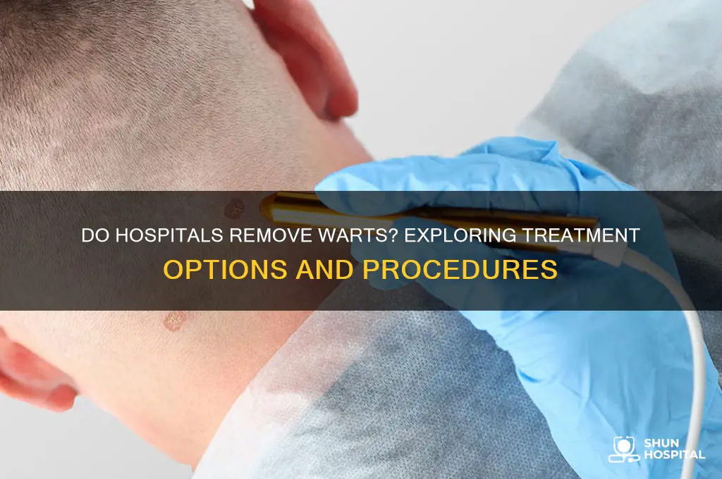 do hospitals remove warts