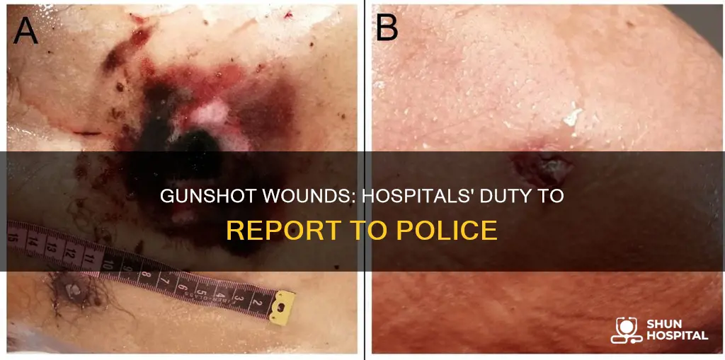 do hospitals report gunshot wounds to police