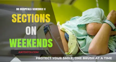 Hospitals and C-Sections: Weekend Scheduling