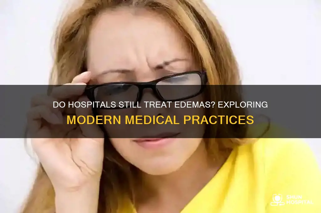 do hospitals still give edemas