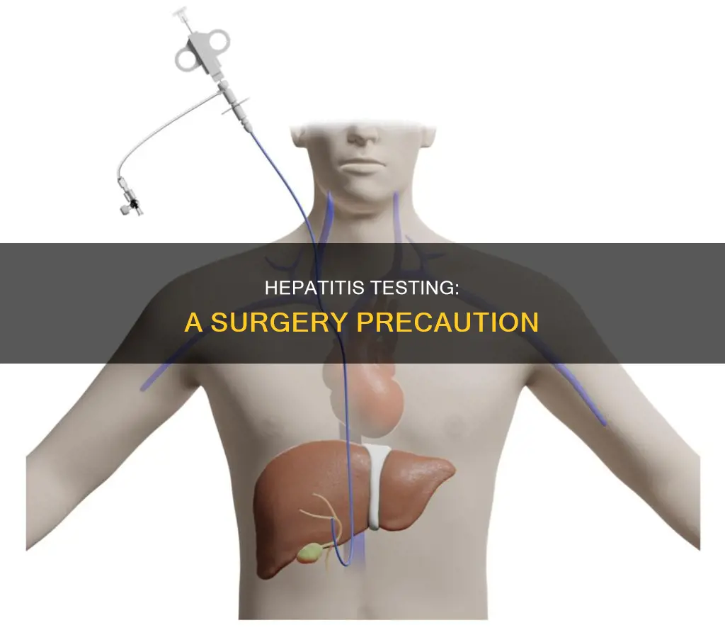 do hospitals test for hepatitis before surgery