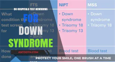 Down Syndrome Testing: What Hospitals Do for Newborns