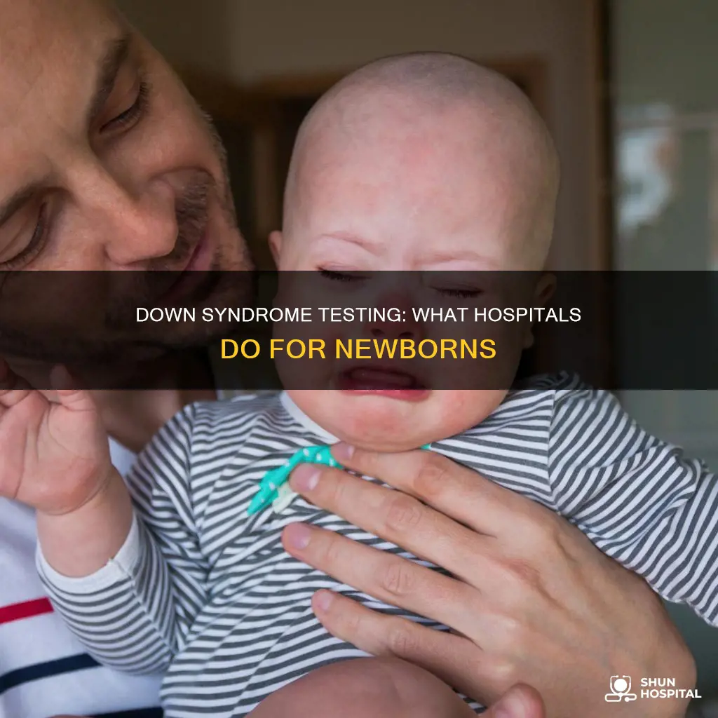 do hospitals test newborns for down syndrome