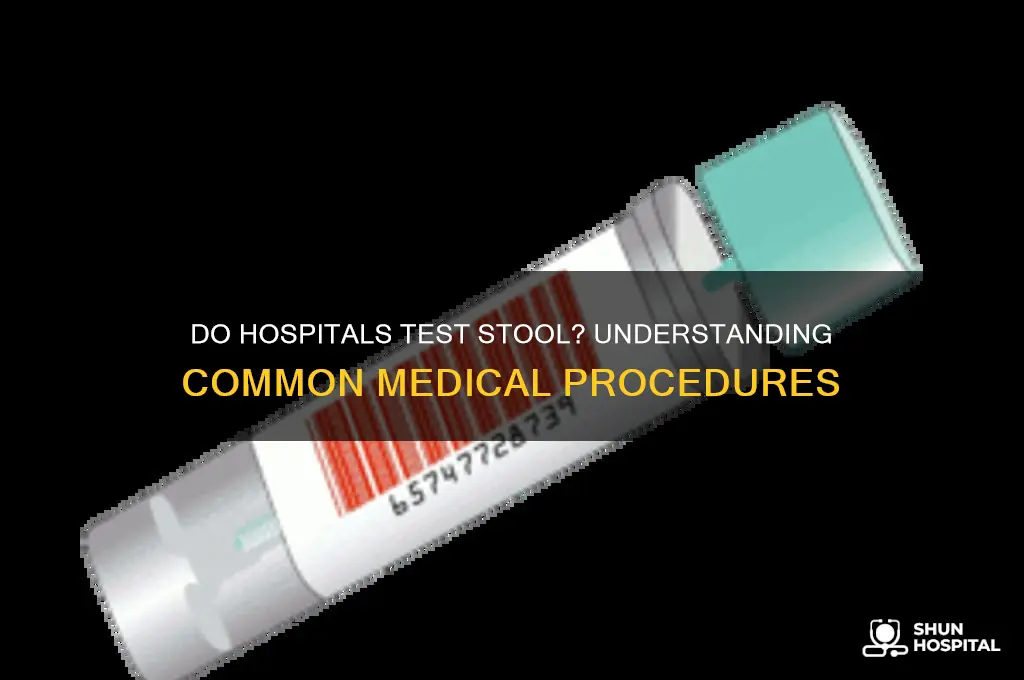do hospitals test stool