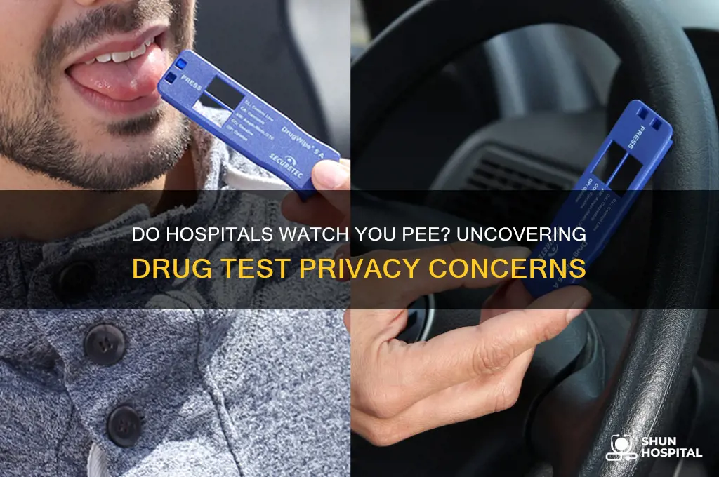 do hospitals watch you pee