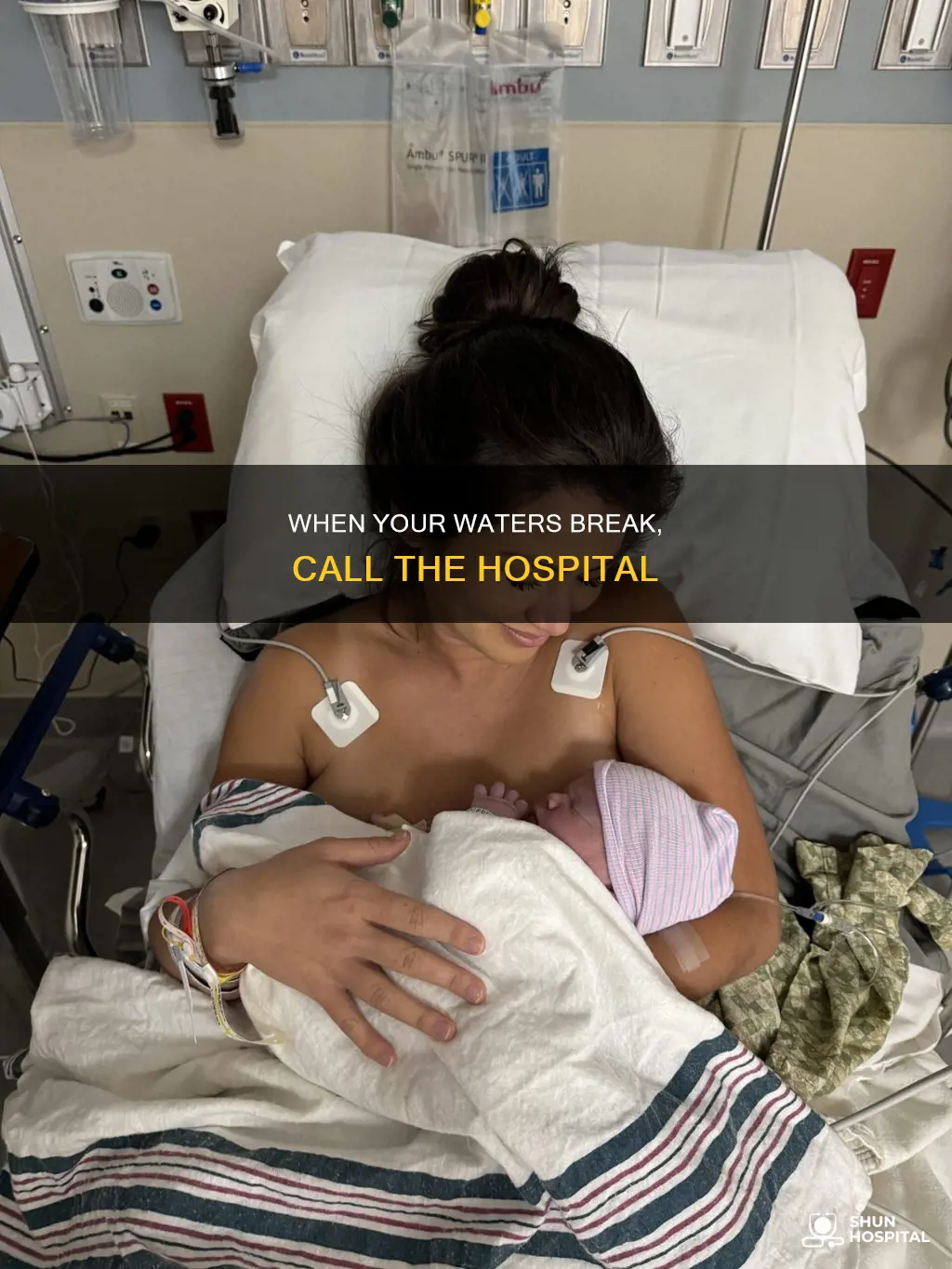 do i call hospital when waters break
