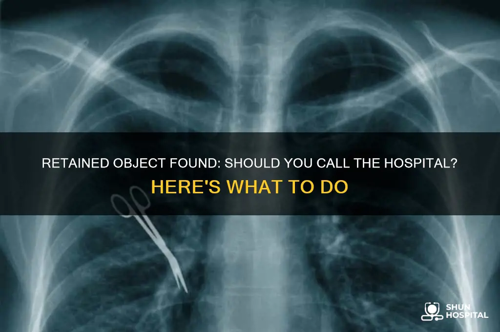 do i call the hospital about retained object found