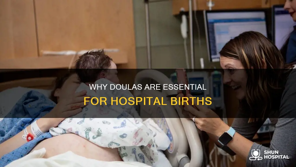 do i need a doula hospital birth