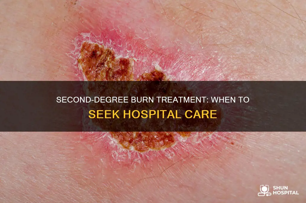 do i need a hospital for 2nd degree burn
