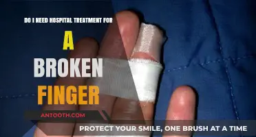 Broken Finger: When to Seek Hospital Treatment and Recovery Tips