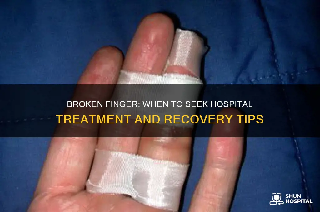 do i need hospital treatment for a broken finger
