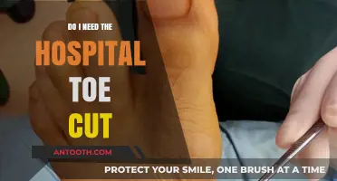 Toe Cuts: When to Head to the Hospital