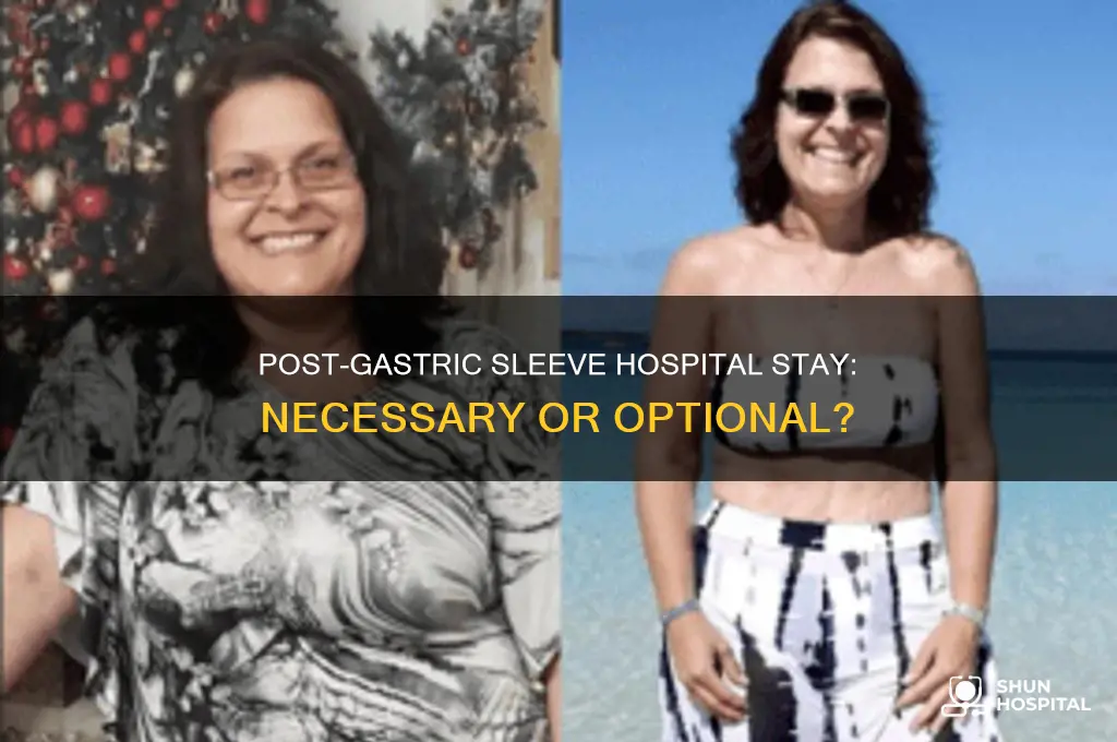 do i need to stay in hospital after gastric sleeve