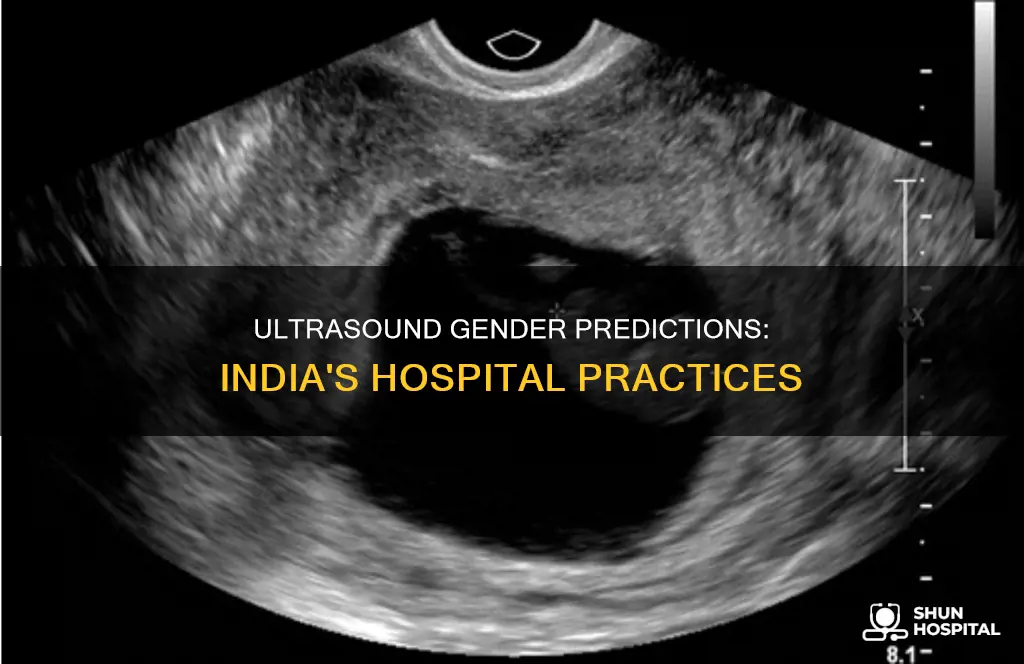 do indian hospitals give ultrasound with gender
