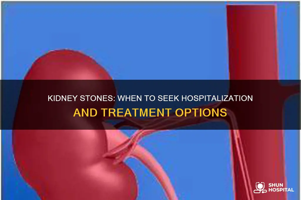 do kidney stones require hospitalization