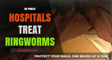 Do Public Hospitals Treat Ringworms? A Comprehensive Guide to Care