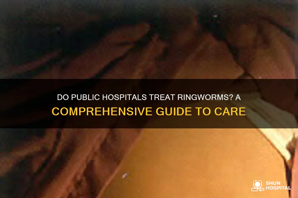 do public hospitals treat ringworms