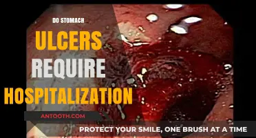Stomach Ulcers: When to Seek Hospitalization for Effective Treatment