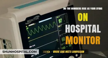 Hospital Monitor Numbers: Do They Spike as Life Fades Away?