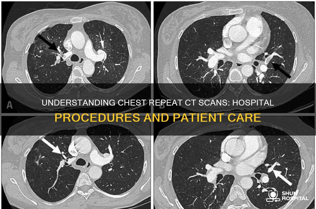 do they do a chest repeat cat scan in hospital