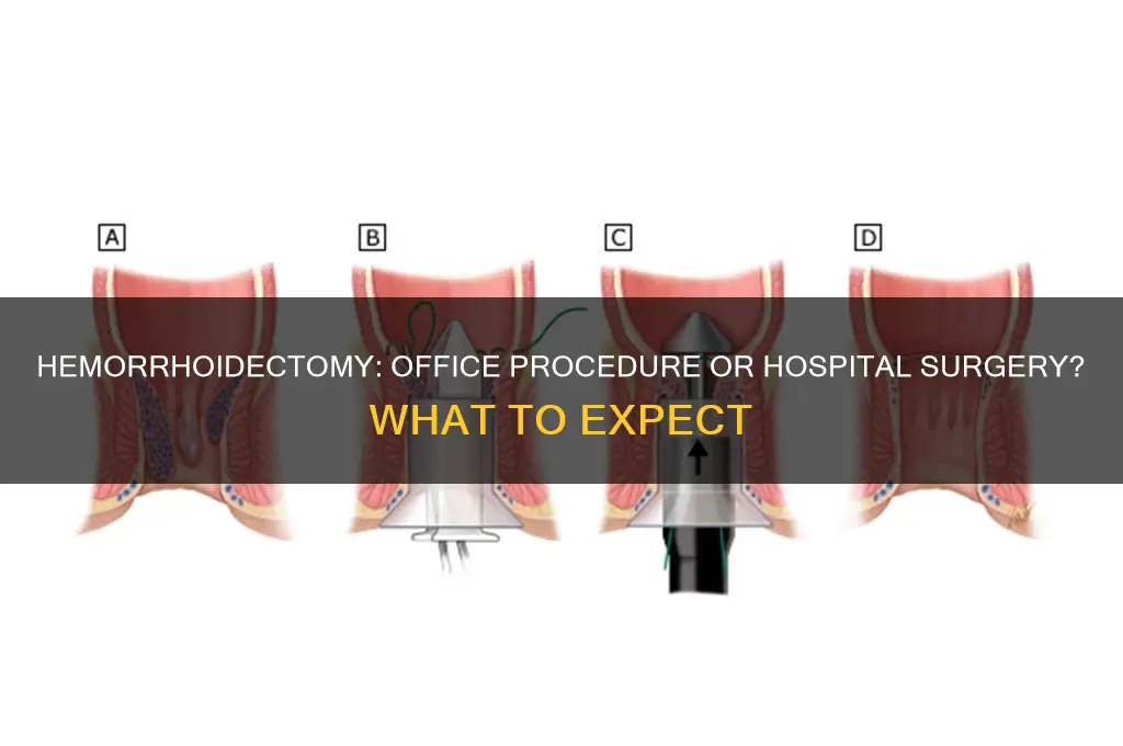 do they do a hemorrhoidectomy in doctors office or hospital
