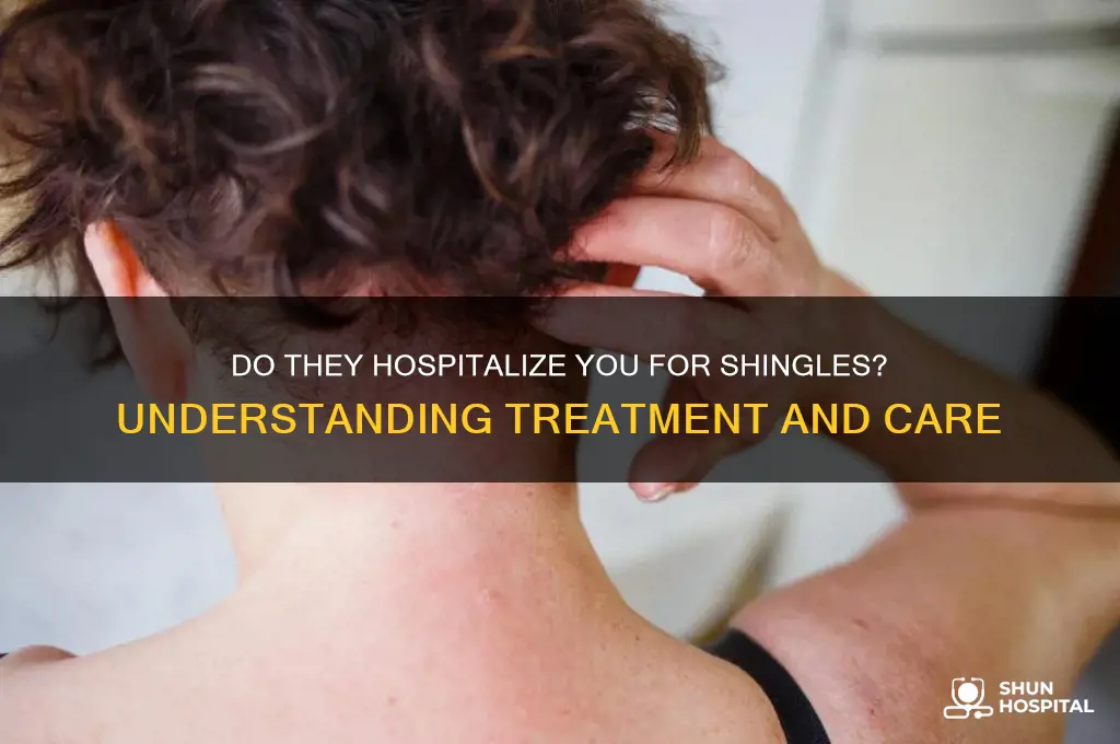 do they hospitalize you forshingles