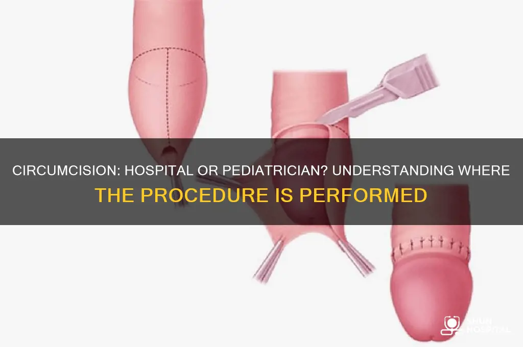 do they preform circumcision in the hospital or pediatrician
