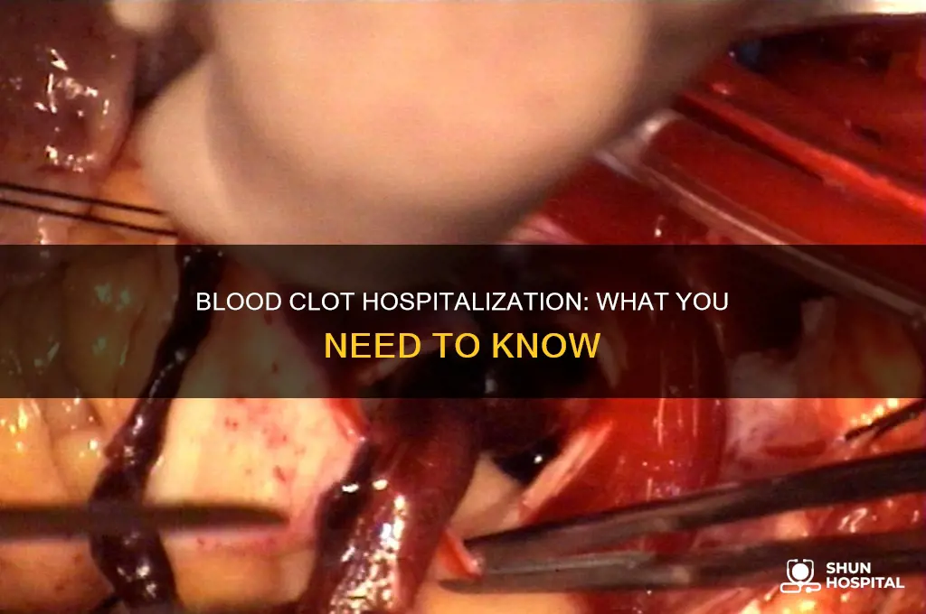 do u have to stay in hospital for blood clot