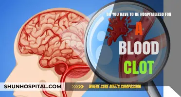 Blood Clot Hospitalization: When Is It Necessary for Treatment?